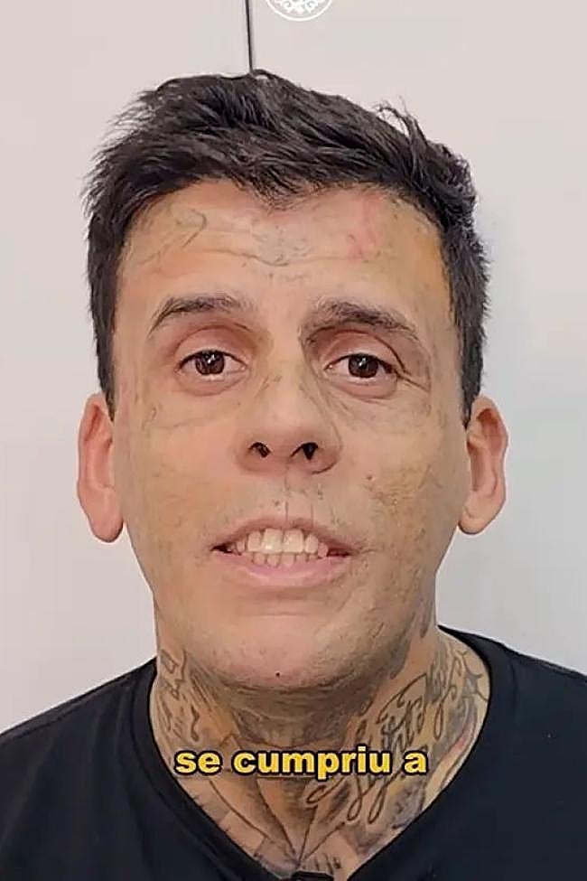Leandro en una de las sesiones apra borrarse los tatuajes