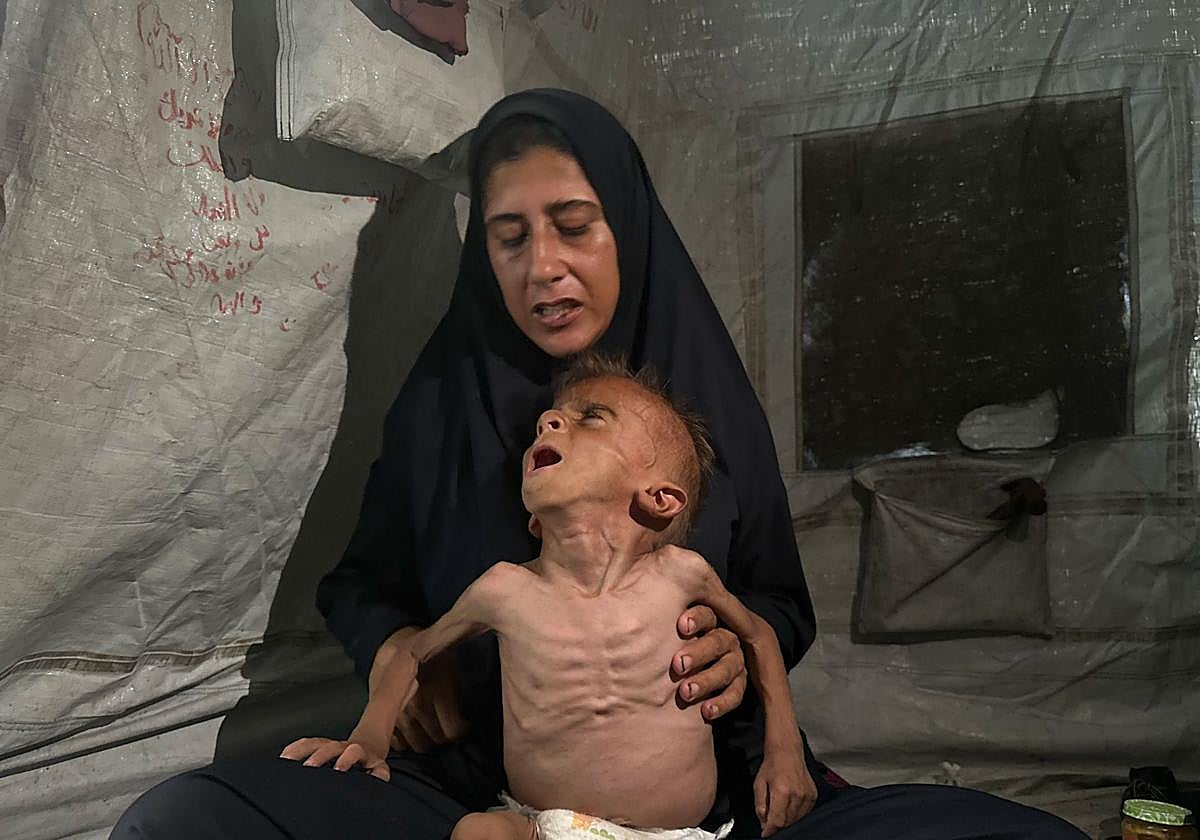 El hambre como arma de guerra