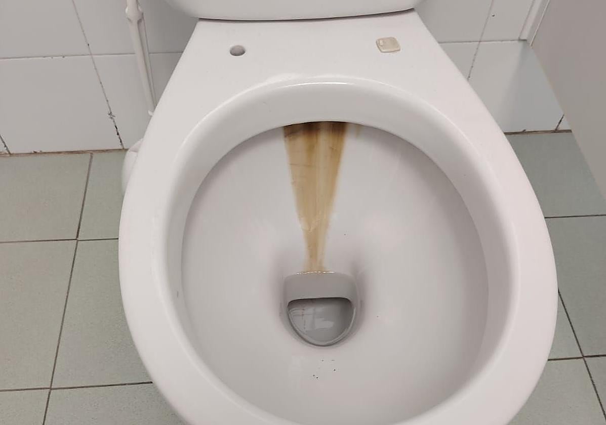 Los inodoros siguen sin tapa y con grandes manchas de cal.