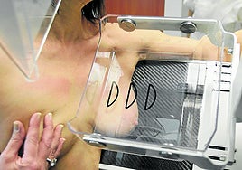 Una mujer se somete a una mamografía