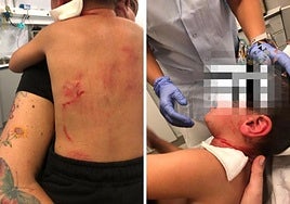 El pequeño Einar, tras sufrir el ataque del perro.