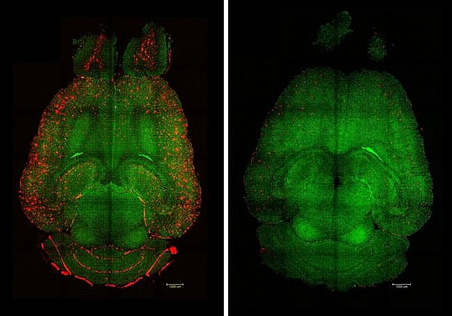 A la izquierda, el cerebro del ratón sin tratamiento, En rojo, las placas amiloides. A la derecha, 12 horas después de administrarle el fármaco.