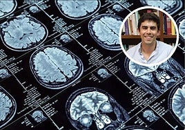 Alejandro Martínez Rico, psiquiatra: «Dormir solo 4 horas hace que tu cerebro funcione como si tuviera 8 años más»