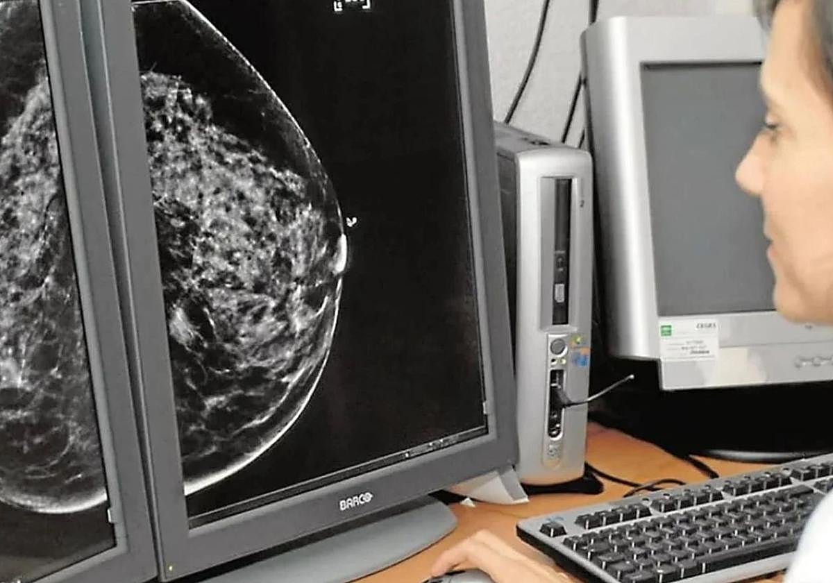 Examen de una mamografía.