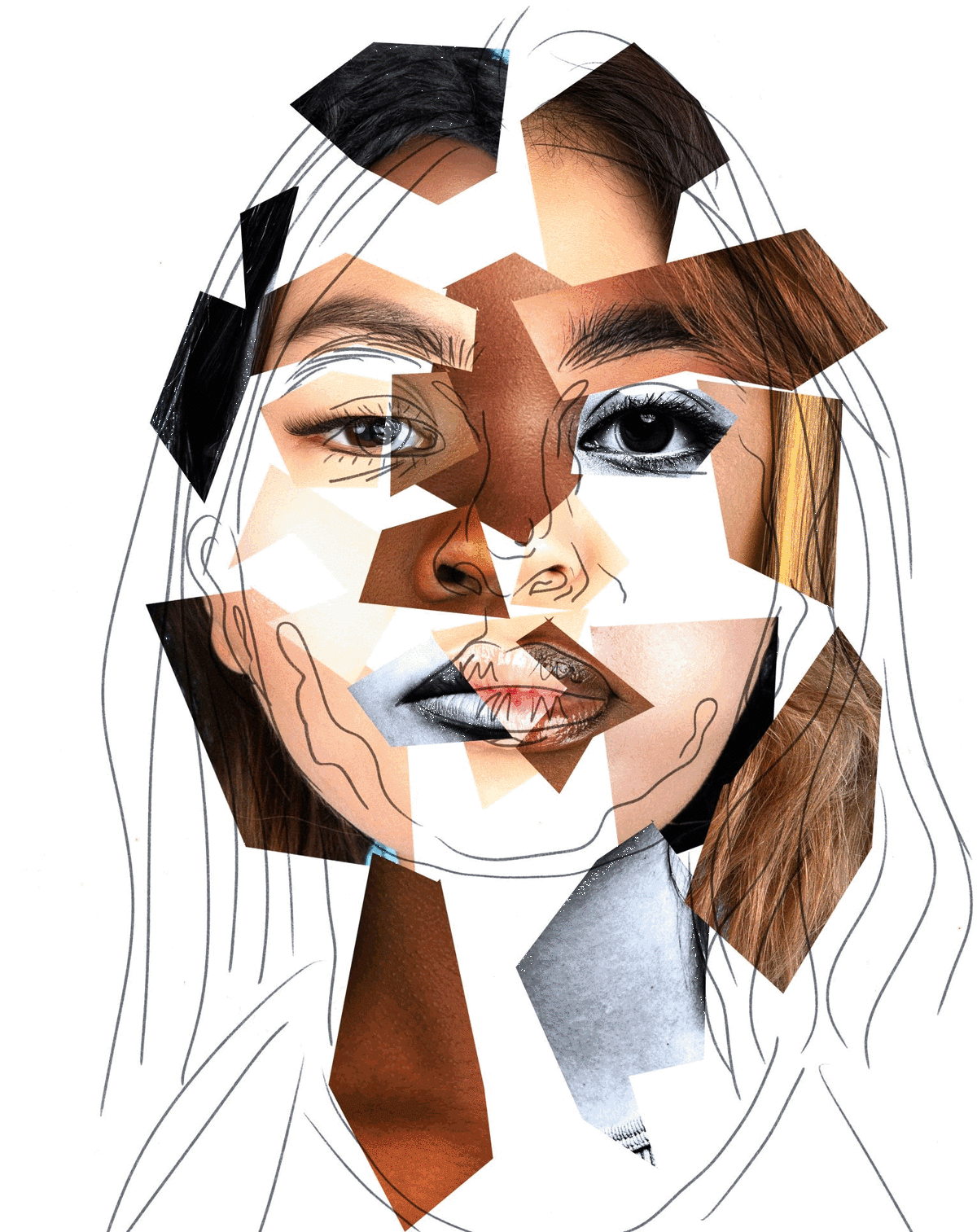 Desastres en la cirugía estética: cuando dejas de reconocerte en el espejo