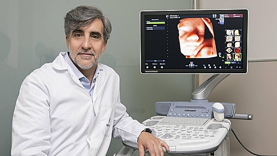 Miomas: cuándo operar y por qué la cirugía mínimamente invasiva marca la diferencia