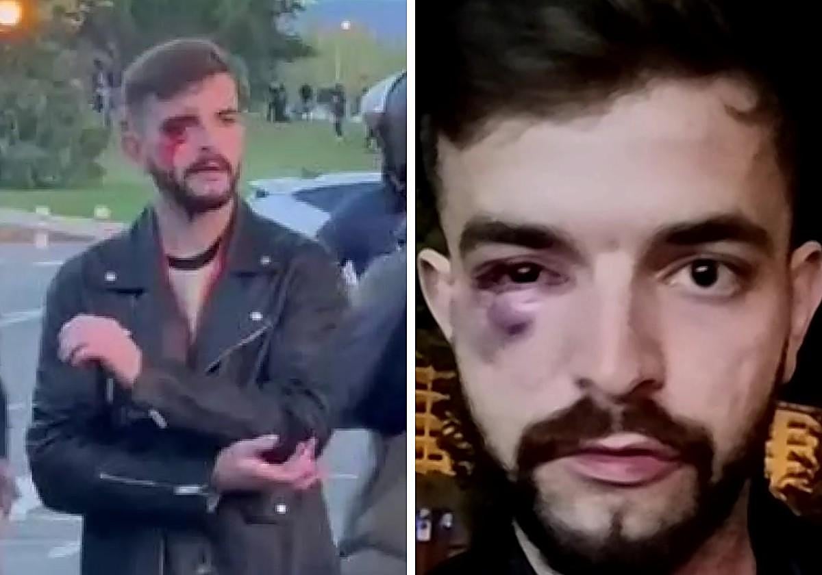 Agreden a un periodista en Pamplona: «Grababa con su acreditación y le gritaron 'hay que darle'»