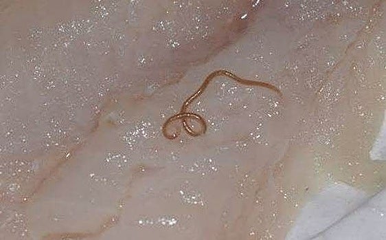 Todas las merluzas y el 20% de las anchoas tienen anisakis, según un informe de Azti