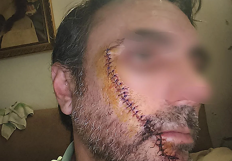 «Si no llego a ver el reflejo del cuchillo, me mata»