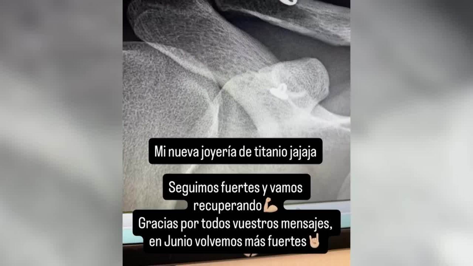 Dani Fernández continúa recuperándose de su aparatosa caída en el Roig Arena