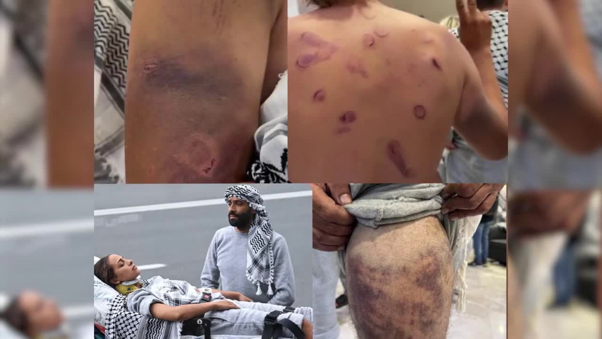 Activistas de la flotilla aplazan por ahora su regreso a España a la espera de exámenes médicos