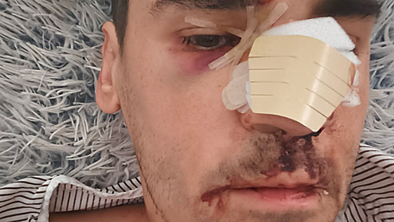 Un colaborador de 'Malas Lenguas' acaba en el hospital tras una agresión: «Fascistas, no me vais a callar»