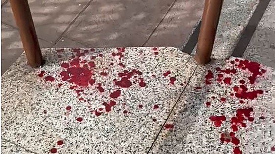 «Me agarraron del cuello y apalearon al pedirles que no entraran en la barra»