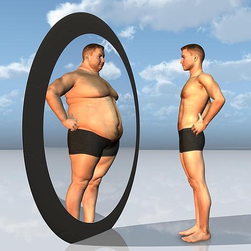 síntomas de la anorexia nerviosa