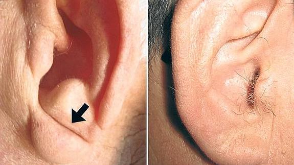 Una oreja con pliegue (izda) y otra sin pliegue (dcha).