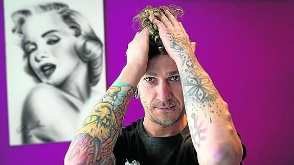 Alex muestra las cuatro semibolas y el aro que se implantó en el brazo izquierdo hace seis años.