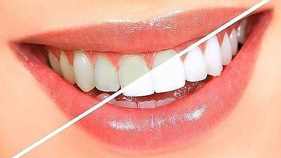 Cómo conseguir unos dientes blancos sin gastarse una fortuna