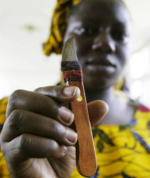 Una mujer de Costa de Marfil sujeta una herramienta antes de realizar una ablación.