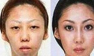 La mujer, antes y después de las cirugías plásticas