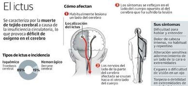 Los ictus juveniles se disparan a causa de los malos hábitos de vida