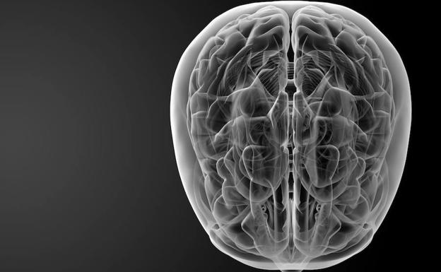 Cerebro humano visto a través de rayos x.