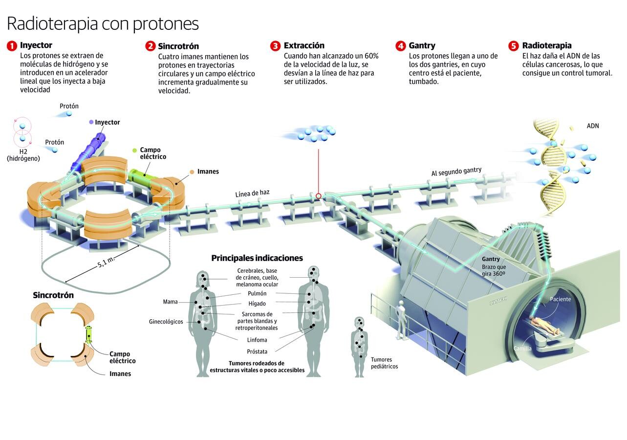 Radioterapia de protones