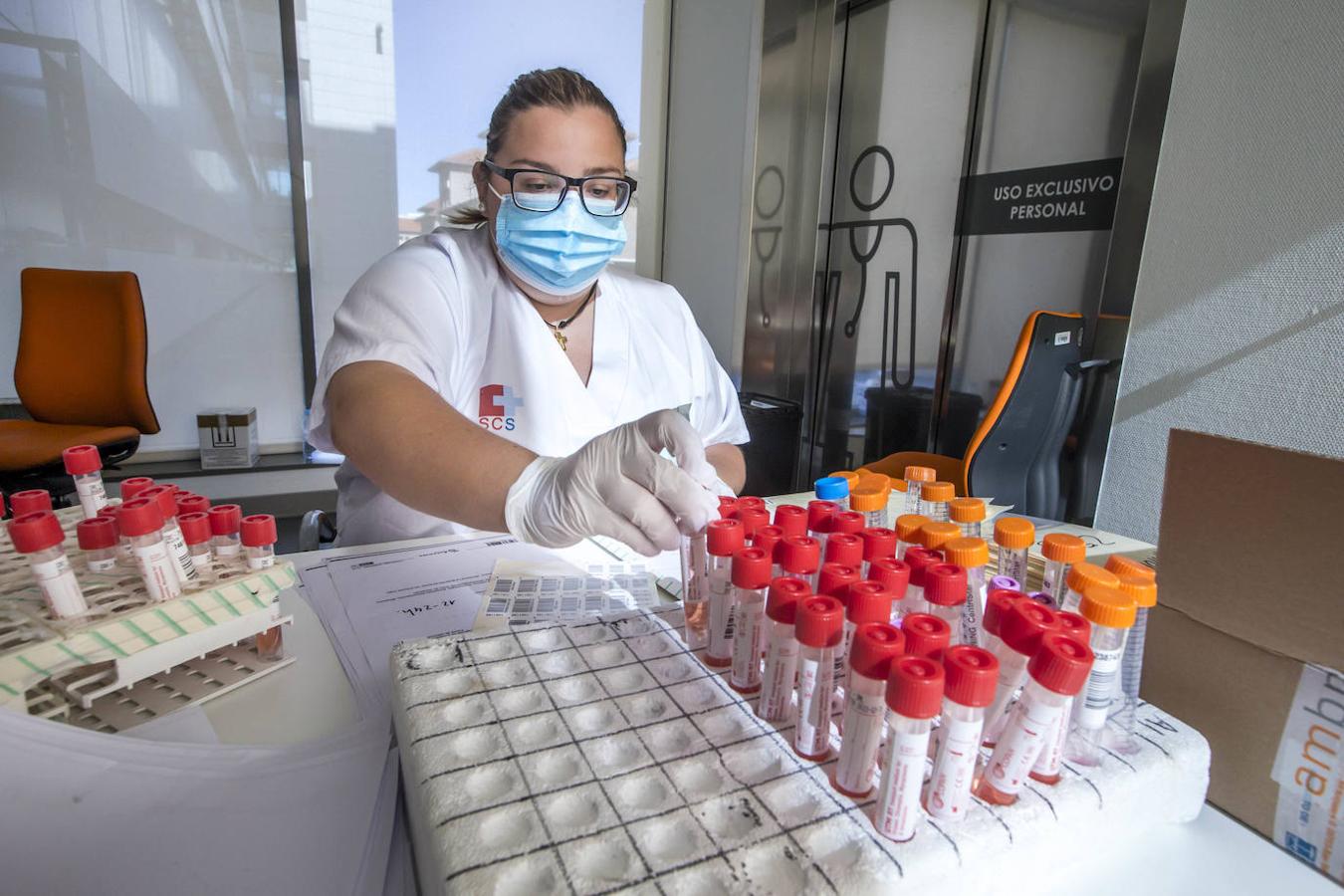 El laboratorio de Microbiología realiza más de 1.500 PCR diarias en busca del patógeno, oculto en un 6% de las pruebas.