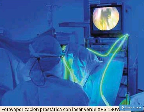 Imagen principal - Fotovaporización prostática con laser verde XPS 180W