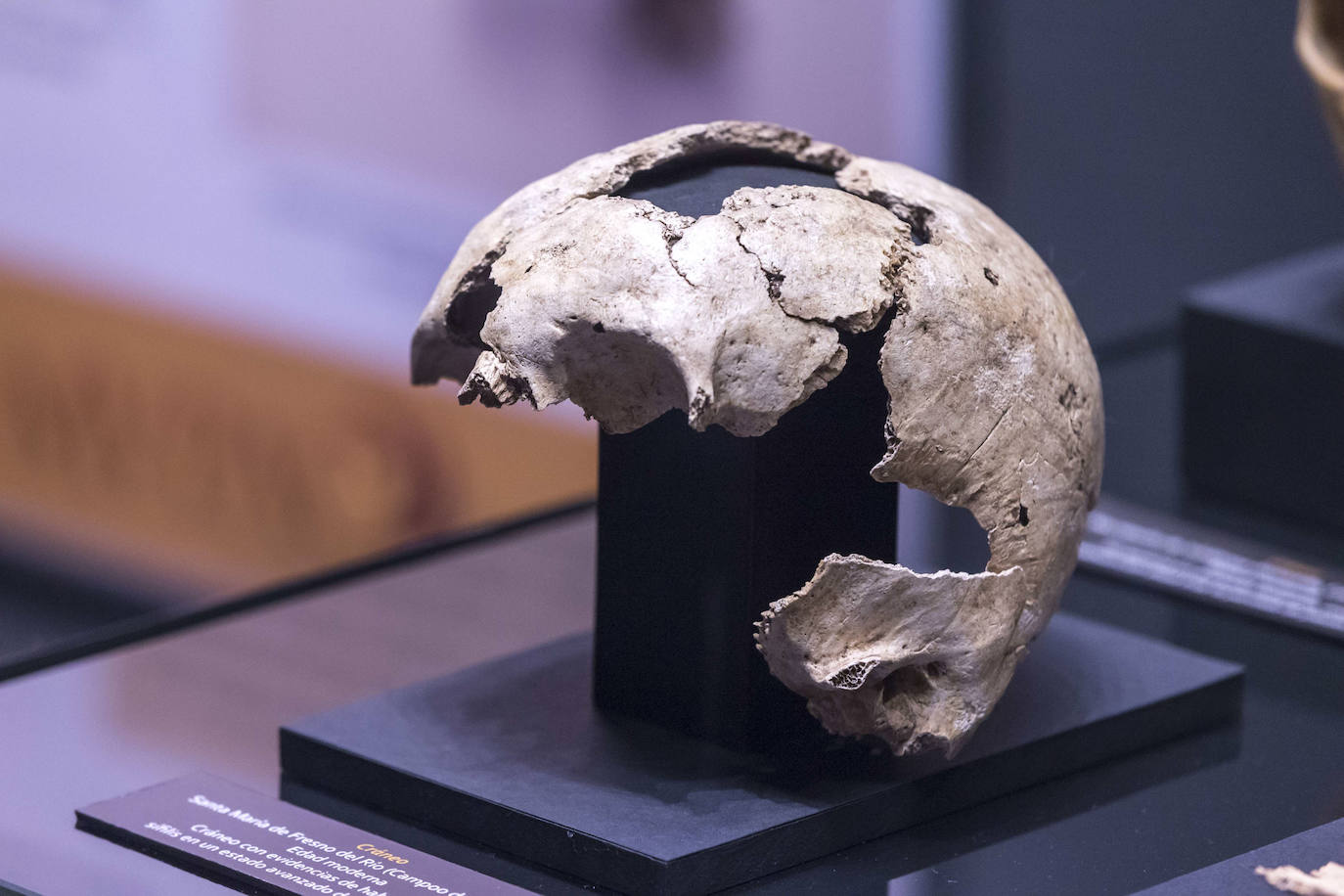 El Museo de Prehistoria y Arqueología de Cantabria (MUPAC) acoge hasta final de año una exposición que muestra cómo los restos humanos sirven para conocer la historia de la región a través de la información que aportan sobre cómo vivieron y murieron las personas.