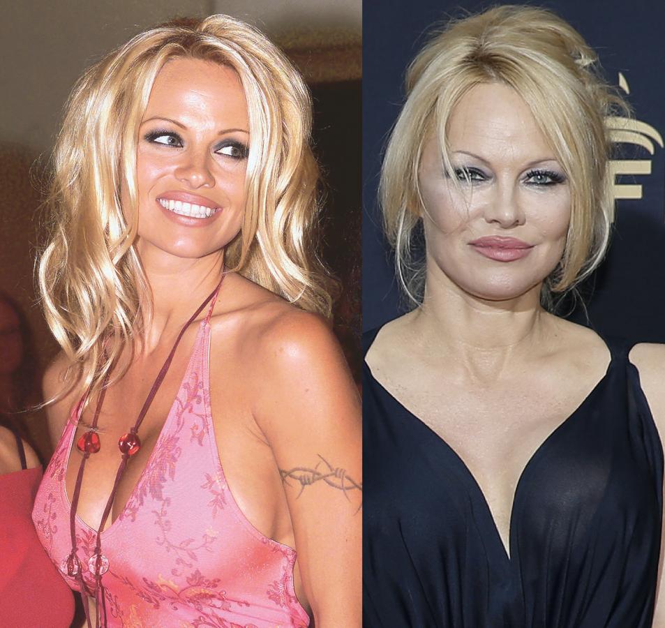 Pamela Anderson