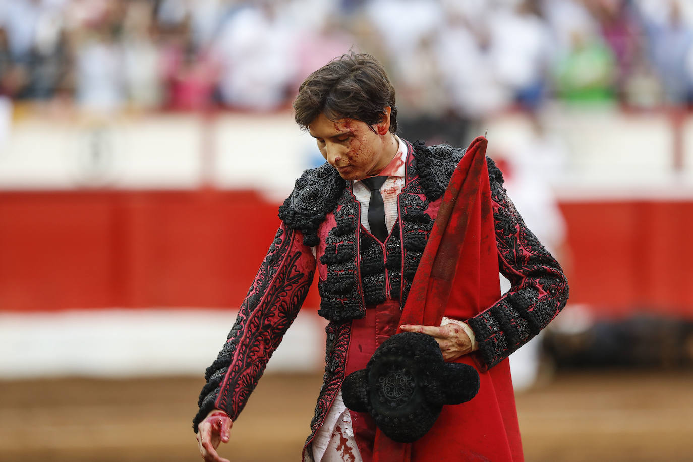 La cara ensangrentada de Roca Rey da una idea de la dureza de la faena de Santiago. 