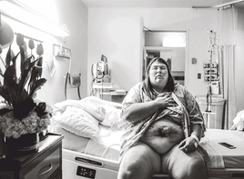 Se sometió a un 'bypass' gástrico para superar su obesidad