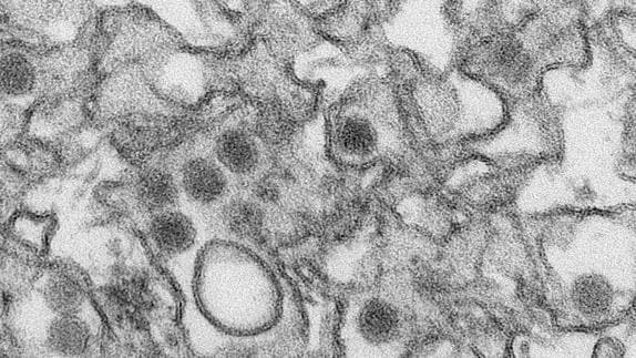 Micrografía electrónica de transmisión del virus zika. 