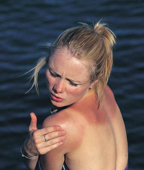 El problema de usar una crema solar caducada es que no hace efecto. 