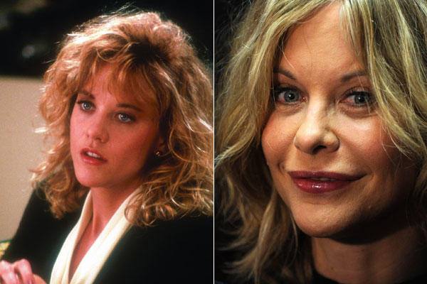 Meg Ryan era considerada como una de las actrices más bellas de EE UU. Ahora, su rostro refleja un excesivo gusto por el botox, el rellenado de labios y el retoque de pómulos. Una pena.