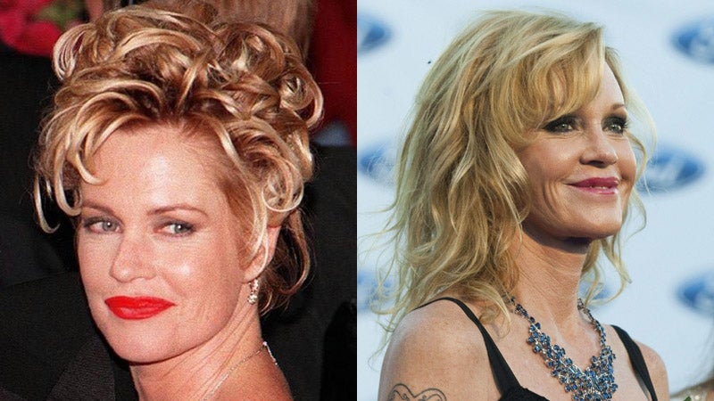 La actriz Melanie Griffith es otra de las celebridades que lleva años sorprendiéndonos con sus espectaculares cambios faciales.