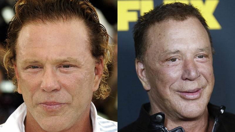 El actor y boxeador Mickey Rourke se ha pasado con la cirugía y con el botox.