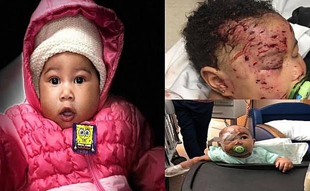 Un mapache ataca a una bebé en su casa y la red se vuelca con su familia para que pueda mudarse