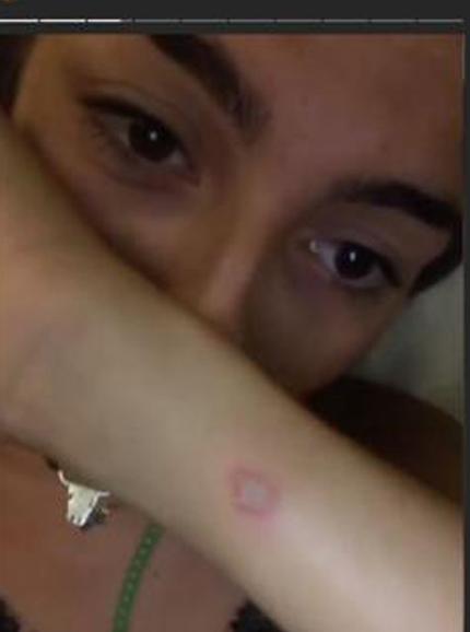 Ana muestra su herida. 