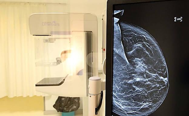 Mamógrafo digital del Hospital General de Segovia.