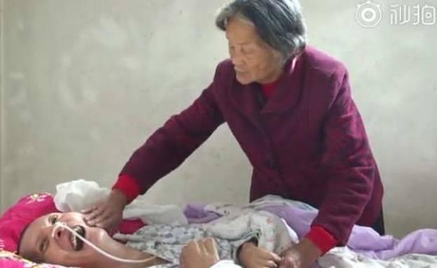 Wang Shubao despierta tras estar 12 años en coma. 