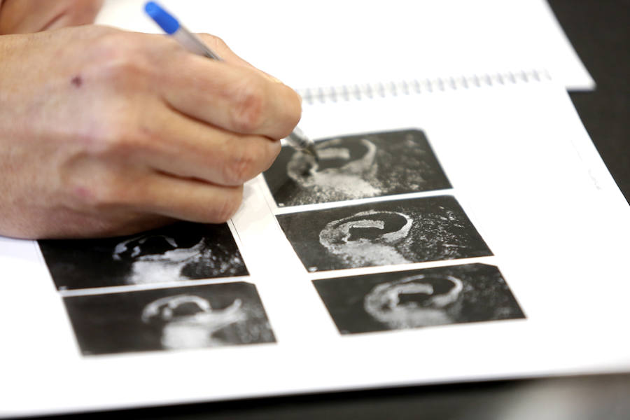 Fotos: Sistema de identificación policial mediante la obtención de huellas de una oreja