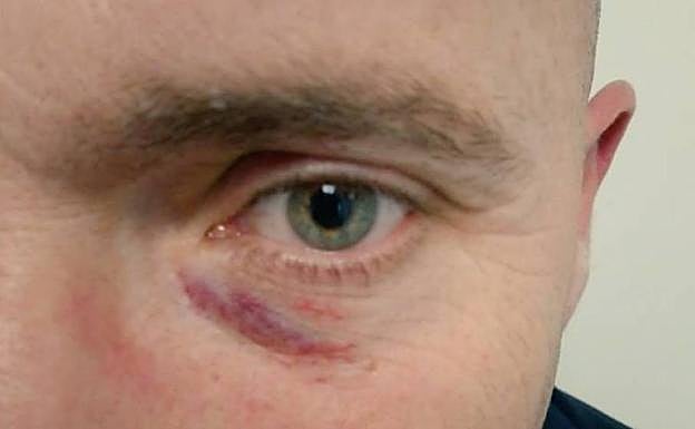 Imagen del coordinador de Vox que fue agredido. 