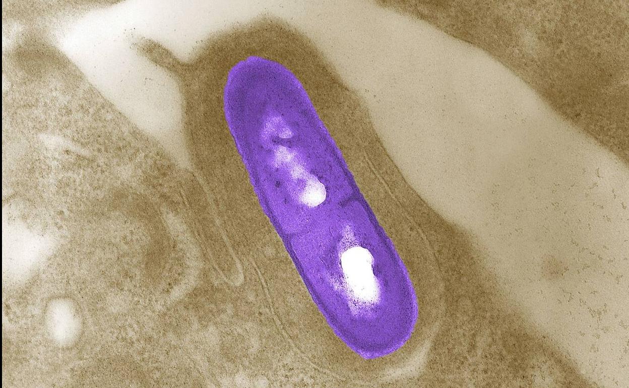 Bacteria de la listeriosis.