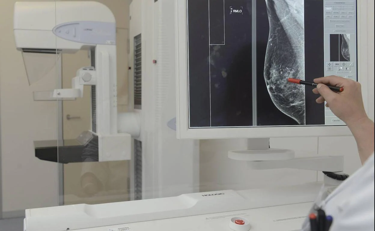 Análisis de una mamografia digital en una unidad de lectura de mamografía de las que dispone el Sacyl.