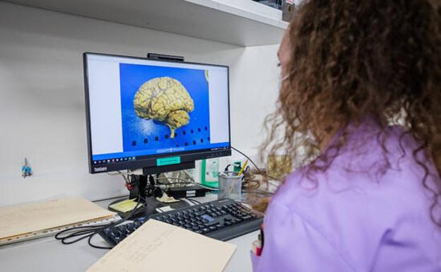 Una técnico observa muestras de cerebro recogidas. 