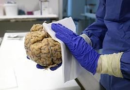 Una investigadora limpia un cerebro donado al banco del hospital valenciano de La Fé.