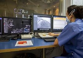 Unidad de Hemodinámica del Hospital Campo Grande Recoletas de Valladolid.