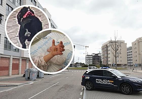 Entorno de la calle del Arca 5, lugar del suceso. En los círculos, la mano herida del niño y captura del perro con la que trabaja la Policía Nacional.
