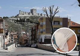 En detalle, el vendaje que recubre el oído lesionado del menor agredido en Peñafiel.